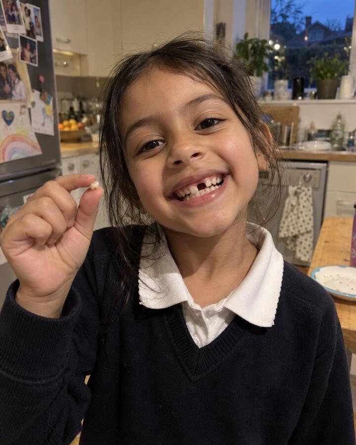 A young girl grinning to show the gap where her front tooth was